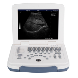 ARM-580BWT portable ultrasound machine