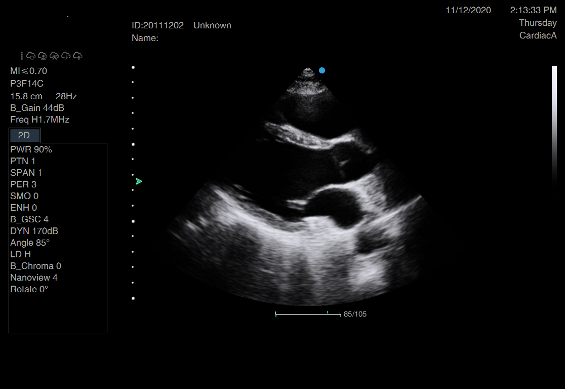 左室长轴切面-1