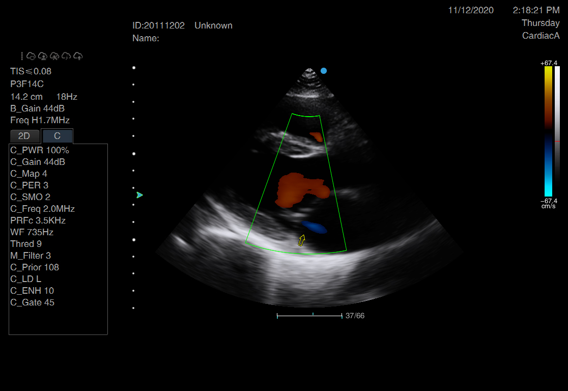 左室长轴-color-1