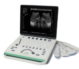 Portable Laptop B/W Ultrasound Machine AU-300S